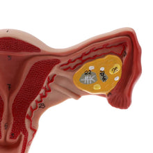 Load image into Gallery viewer, 1:1 Human Female Uterus Ovary Fallopian Tubes Model Anatomical human anatomy model medical teaching tools