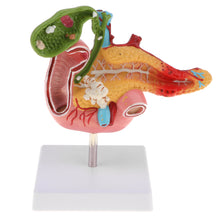 Load image into Gallery viewer, 1:1 Life Size Anatomical Human Pancreas Duodenum Gallbladder Pathology Model, Lab Office Equipment Ornament for Students