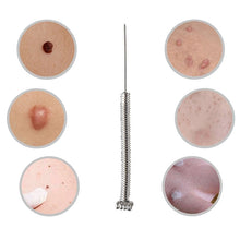 Load image into Gallery viewer, 100 Pcs Mini Mole Removal Pen Needles for Spot Mole Freckle Plasma Point Pen Machine Beauty Equipment