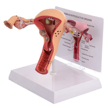 Load image into Gallery viewer, 1Pc Female Reproductive Organs Anatomy Model Uterus Model for