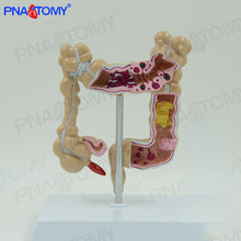 Load image into Gallery viewer, Human Model Simulation Human Colon Anatomy Model Anorectal Intestinal Gastrointestinal Digestive System Teaching Model