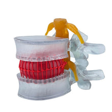 Load image into Gallery viewer, Anatomy Lumbar Spine Model with Movable Lumbar Disc for Demonstrating Pathological Lumbar Disc Lumbar Vertebra Y3NC