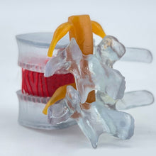 Load image into Gallery viewer, Anatomy Lumbar Spine Model with Movable Lumbar Disc for Demonstrating Pathological Lumbar Disc Lumbar Vertebra Y3NC