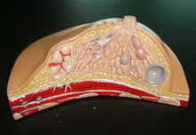 Load image into Gallery viewer, Breast Disease Breast Anatomy Model Human Body Model Anatomical Human Pathological Breast Model Medical Disease & Cancer Anatomy