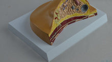 Load image into Gallery viewer, Breast Disease Breast Anatomy Model Human Body Model Anatomical Human Pathological Breast Model Medical Disease & Cancer Anatomy