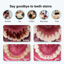 Load image into Gallery viewer, Electric Sonic Dental Calculus Scaler Oral Teeth Tartar Remover Plaque Stains Cleaner Removal Teeth Whitening Portable with LED 0ral irrigator