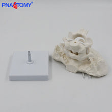 Load image into Gallery viewer, Enlarged Detachable Human Cervical Vertebra Atlas and Axis Bone Spine Anatomical Model Medical Equipment Teaching Tool Skeleton