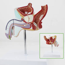 Load image into Gallery viewer, Human Male Genitourinary System Model Andrology Model Prostate Anatomical Model