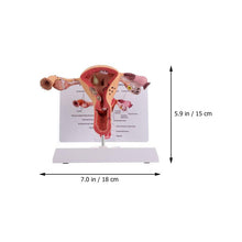 Load image into Gallery viewer, 1Pc Female Reproductive Organs Anatomy Model Uterus Model for
