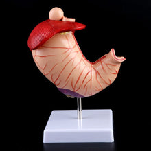 Load image into Gallery viewer, Human Anatomical Anatomy Stomach Medical Model Gastric Pathology Gastritis Ulcer Medical Teaching Learning Tool