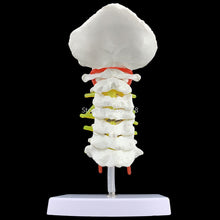 Load image into Gallery viewer, Human Anatomical Model Cervical Vertebra Model Cervical Spine with Neck Artery Occipital Bone Disc and Nerve Model 18 x 13 x 8cm