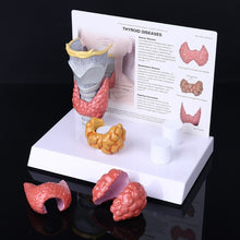 Load image into Gallery viewer, Human Anatomical Thyroid Gland Model Pathology Anatomy Digestive System Display Study Teaching Tool Halloween