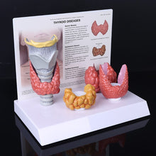 Load image into Gallery viewer, Human Anatomical Thyroid Gland Model Pathology Anatomy Digestive System Display Study Teaching Tool Halloween