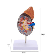 Load image into Gallery viewer, Human Body Organ Viscera Healthy Kidney Anatomy With Adrenal Gland Model Medical Teaching Supplies