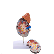 Load image into Gallery viewer, Human Body Organ Viscera Healthy Kidney Anatomy With Adrenal Gland Model Medical Teaching Supplies
