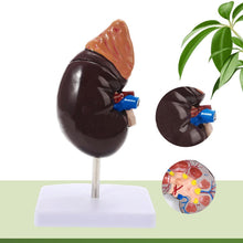 Load image into Gallery viewer, Human Body Organ Viscera Healthy Kidney Anatomy With Adrenal Gland Model Medical Teaching Supplies