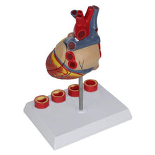 Load image into Gallery viewer, Human Heart Anatomy Model with 4 Stage Thrombus Medical Science Teaching Resources Drop Shipping