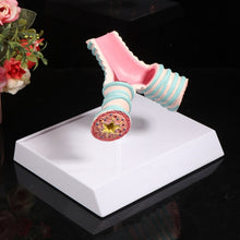 Load image into Gallery viewer, Human Organ Anatomy Model Realistic Bronchus Anatomical Model 4.9'' with Holder