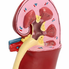 Load image into Gallery viewer, Kidney Pathology Model Human Anatomy Pathological Kidney Model for Physician's Office Educational Tool GPI Anatomy