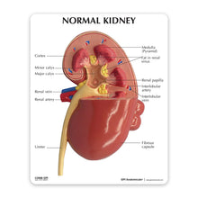 Load image into Gallery viewer, Kidney Pathologies Model Human Body Anatomy Replica of Diseased Kidney for Doctors Office Educational Tool GPI Anatomicals