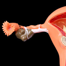 Load image into Gallery viewer, Medical props model Free postage Pathological Uterus Ovary Anatomical Model Anatomy Cross Section Study Tool