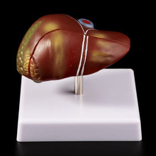 Load image into Gallery viewer, Medical props model Human Liver Pathological Anatomical Model Anatomy School Medical Teaching Display Tool Lab Equipment