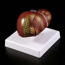 Load image into Gallery viewer, Medical props model Human Liver Pathological Anatomical Model Anatomy School Medical Teaching Display Tool Lab Equipment