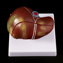 Load image into Gallery viewer, Medical props model Human Liver Pathological Anatomical Model Anatomy School Medical Teaching Display Tool Lab Equipment
