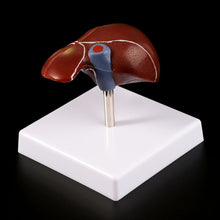 Load image into Gallery viewer, Medical props model Human Liver Pathological Anatomical Model Anatomy School Medical Teaching Display Tool Lab Equipment