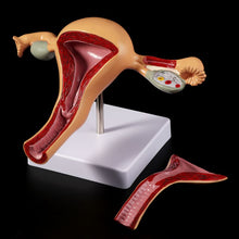 Load image into Gallery viewer, Medical props model Human Pathological Uterus Ovary Model Anatomical Anatomy Disease Pathology Medical Lesion For Teaching