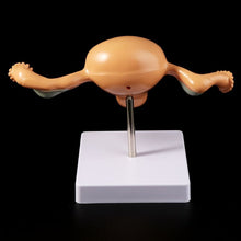 Load image into Gallery viewer, Medical props model Human Pathological Uterus Ovary Model Anatomical Anatomy Disease Pathology Medical Lesion For Teaching
