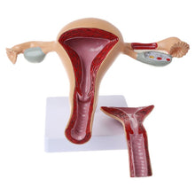 Load image into Gallery viewer, Medical props model Human Pathological Uterus Ovary Model Anatomical Anatomy Disease Pathology Medical Lesion For Teaching