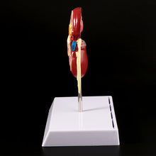 Load image into Gallery viewer, Medical props model Life Size Human Kidney Diseased Model Anatomical Anatomy Diseased Pathological Stone Organ Teaching Supplies