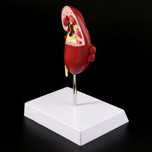 Load image into Gallery viewer, Medical props model Life Size Human Kidney Diseased Model Anatomical Anatomy Diseased Pathological Stone Organ Teaching Supplies