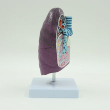 Load image into Gallery viewer, Human Pathological Lung Model Simulation Smokers Lung Internal Organs Specimen Thoracic Surgery Respiratory Department Teaching Aids