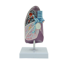 Load image into Gallery viewer, Human Pathological Lung Model Simulation Smokers Lung Internal Organs Specimen Thoracic Surgery Respiratory Department Teaching Aids