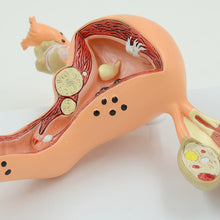 Load image into Gallery viewer, Human Body Model Female Reproductive Uterus Vagina Ovary Uterus Teaching Mold Pathological Changes Popular Science Training Teaching Aids