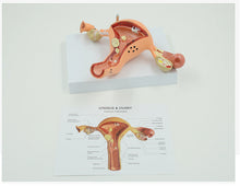 Load image into Gallery viewer, Human Body Model Female Reproductive Uterus Vagina Ovary Uterus Teaching Mold Pathological Changes Popular Science Training Teaching Aids