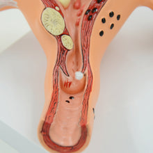 Load image into Gallery viewer, Human Body Model Female Reproductive Uterus Vagina Ovary Uterus Teaching Mold Pathological Changes Popular Science Training Teaching Aids
