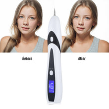 Load image into Gallery viewer, Plasma Jet Pen Electric Anti Wart Cauterizer Berrugas Eliminator Laser Freckles Removal Papilloma Remedy Mole Removes Polka Dots