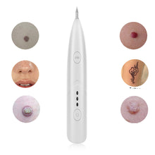 Load image into Gallery viewer, Plasma Pen Black Point Dots Vacuum Cleaner Laser Freckle Removal Machine Skin Mole Dark Spot Face Wart Tag Tattoo Remover Beauty