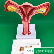 Load image into Gallery viewer, Ovary and uterus disease Dissection model Pathology Female uterus model teaching human medical aids anatomy lesion uterus