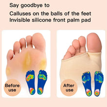 Load image into Gallery viewer, Insole Silicone Gel Half s Women men Metatarsal Pads Heels Half Honeycomb Breathable Relief Moisture Wicking Forefoot Pad shoe pads