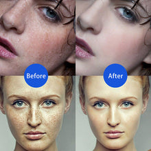Load image into Gallery viewer, Skin Tag Remover Electric Plasma Pen Pore Cleaner Mole Wart Tattoo Freckle Dark Spot Removal for Face Beauty Facial Skin Care