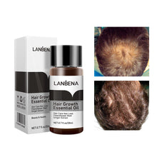 Load image into Gallery viewer, Hair Growth Oil Hair Care Essential Oil Export