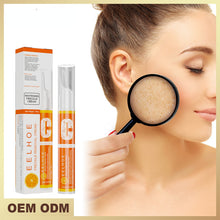 Load image into Gallery viewer, VC Bright White Despeckle Cream Mark Removal Pen Remove Color Spots Dark Fleck Removal Pen Brighten Skin Despeckle Cream