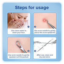 Load image into Gallery viewer, llano Acne Remover Needles Blackhead Pimple Comedone Extractor Blemish Zit Face Skin Care Cleaner Removal Tools