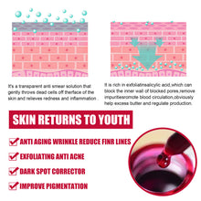 Load image into Gallery viewer, Tartaric Acid Salicylic Acid Essence Exfoliating Closed Blackhead Acne Pore Shrinking Essence