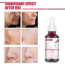 Load image into Gallery viewer, Tartaric Acid Salicylic Acid Essence Exfoliating Closed Blackhead Acne Pore Shrinking Essence