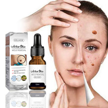 Load image into Gallery viewer, Mole Removal Wart Essence Skin Removal Facial Armpit Flesh Bump Repair Cleaning Care
